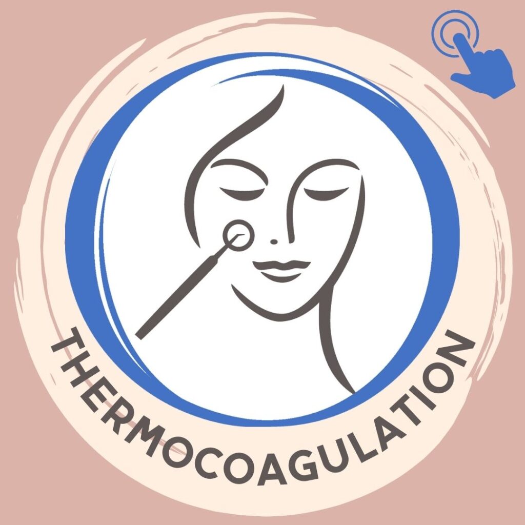 Thermocoagulation