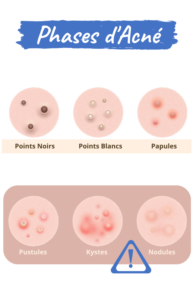 Espace_Beaute_Sublimage_epilation_acne