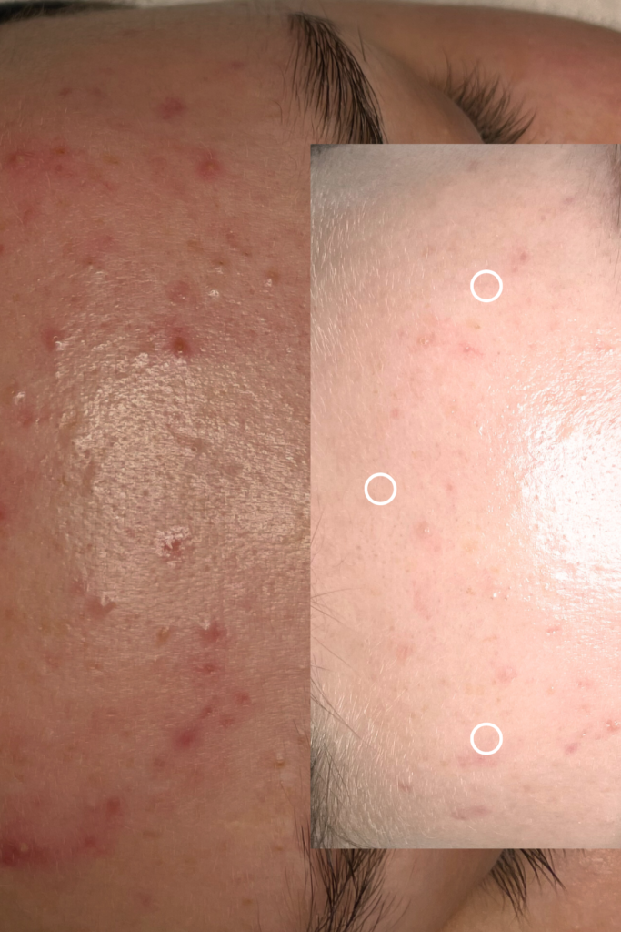 Espace_Beaute_Sublimage_epilation_facial_extractions