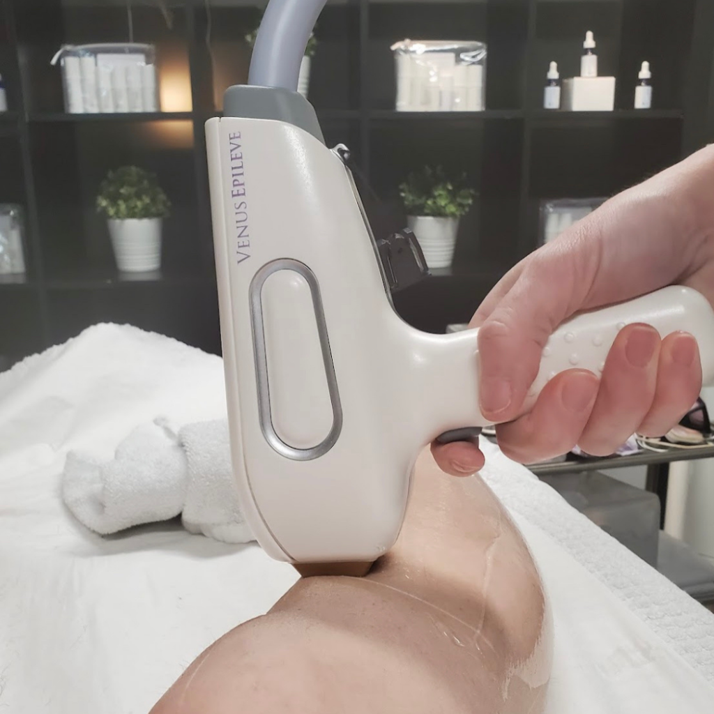 IG Espace_Beaute_Sublimage_Vaudreuil_Esthetique_Peeling_Facial_Épilation_Laser1 (1) Épilation laser