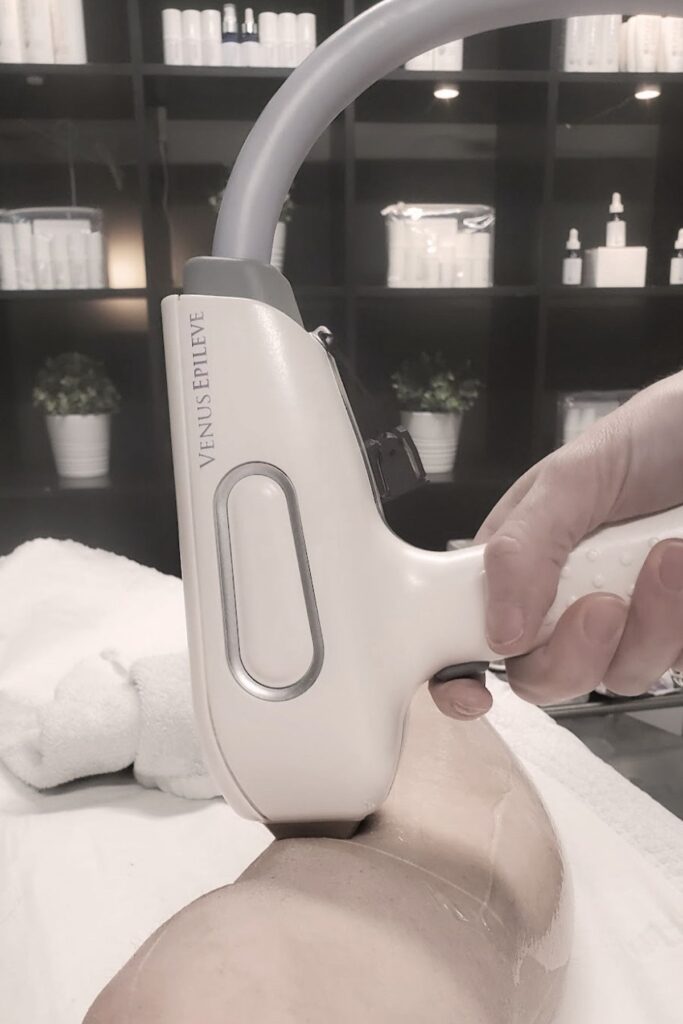 Épilation laser